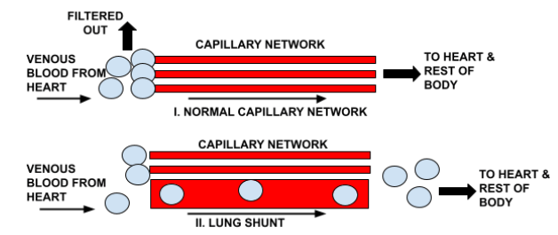 Lung Shunt Mechanism Diagram